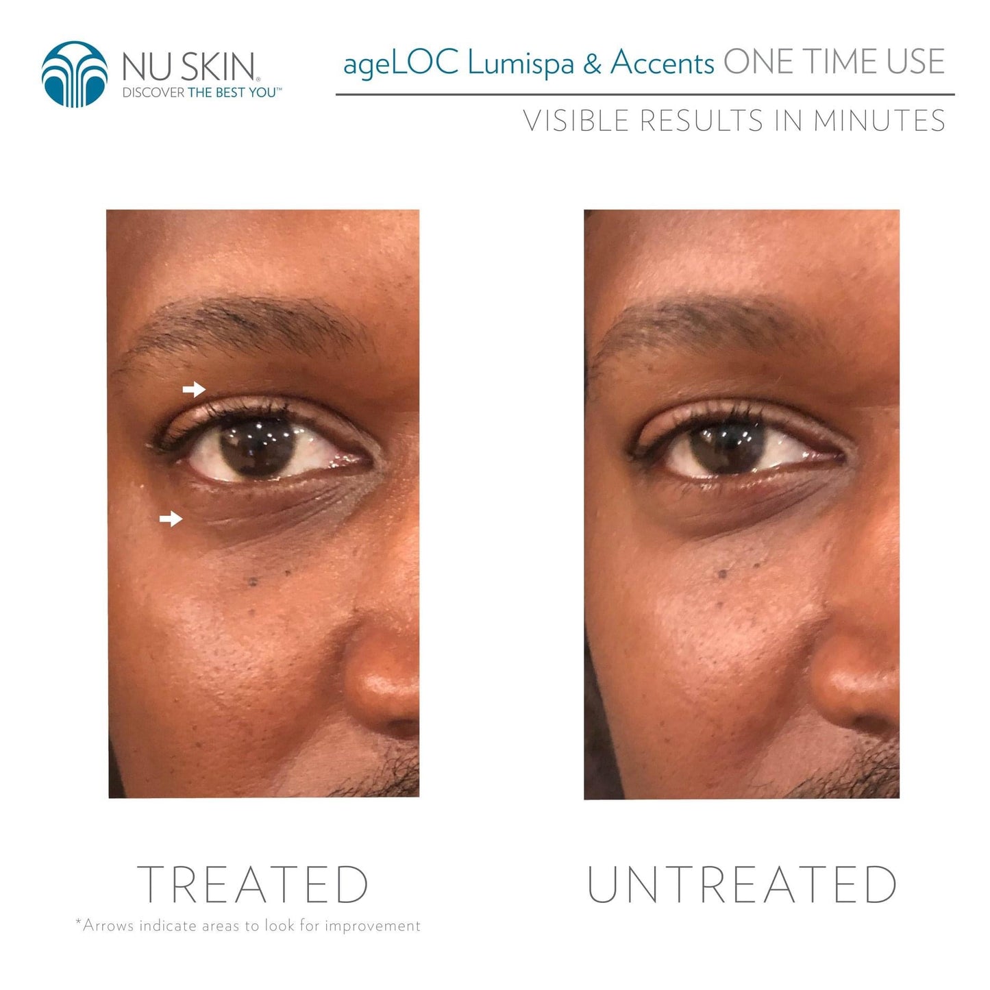 LumiSpa iO Accent & ageLOC LumiSpa IdealEyes - Eye Care Kit